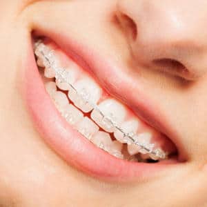 Studio Dentistico Srl servizi di odontoiatria estetica a Thiene Vicenza